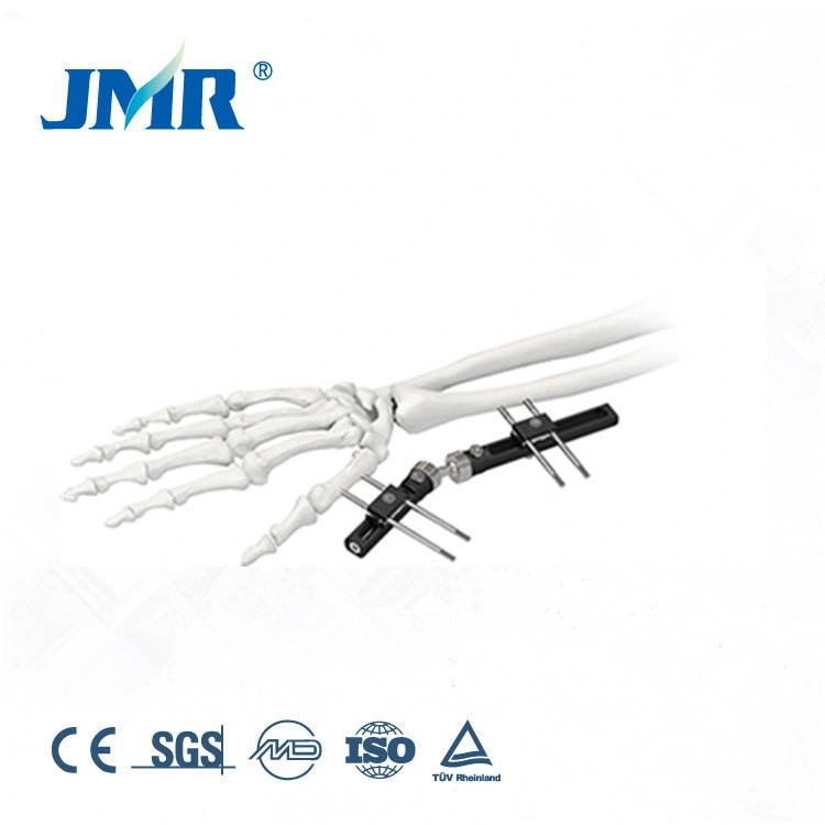 wrist external fixator distal tibia fracture external fixator